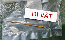 In Vietnam, 7cm toothpick removed after over 4 months inside boy's abdomen
