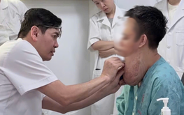 In Vietnam, doctors remove giant decade-old neck tumor from man