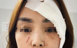 Một phụ nữ ở Nha Trang bị người không quen biết xông vào nhà rạch mặt