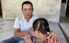 Vụ học sinh lớp 3 bị xe tông tổn thương 90%: Người giao xe có phải chịu trách nhiệm?