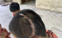 Vụ học sinh lớp 3 bị xe tông tổn thương 90%: Tòa án mời các bên liên quan làm việc lần hai
