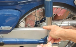 Bé gái 6 tuổi bị cuốn chân vào căm xe máy, gãy xương chày