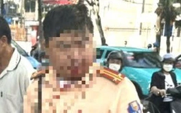 Đang làm nhiệm vụ, trung tá cảnh sát giao thông bị người đàn ông nước ngoài đấm vào miệng