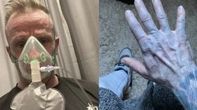 Hoảng hốt nhập viện vì da chuyển... xanh, tìm ra 'thủ phạm' là thứ không ai ngờ