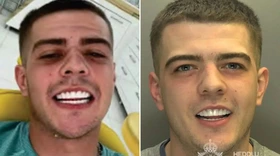 Tên tội phạm bị bắt vì khoe răng 'sáng như quảng cáo'