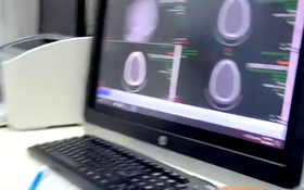 Gia đình bệnh nhân nghi bác sĩ tắc trách, bệnh viện nói chỉ thiếu sót khi in kết quả ra viện