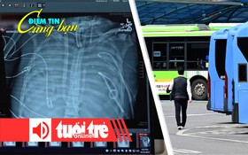 Điểm tin cùng bạn 8h: Sống sót 48 giờ dù không còn phổi; Giới trẻ Hàn Quốc đổ xô làm tài xế xe buýt