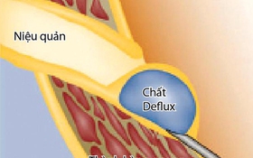 Chích keo sinh học