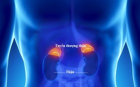 Tuyến thượng thận mệt mỏi