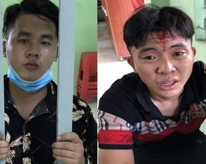 Trinh sát bị trộm đâm thủng đùi phải giấu con: 'ba đi công tác'