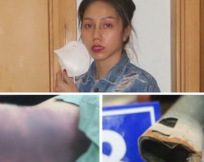 Vụ bé 8 tuổi tử vong do dì ghẻ bạo hành: Bé gái tử vong do sốc chấn thương