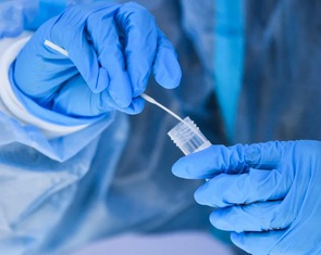 Bộ Y tế: Dịch COVID-19 sẽ diễn biến phức tạp với biến thể XBB