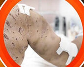 Theo bố tới chỗ làm, bé gái bị 4 con chó cắn hàng trăm vết