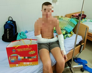 Vụ chó cắn du khách: Nha Trang lập lại đội bắt chó thả rông