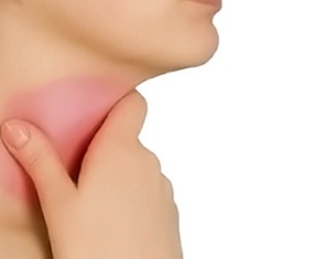Nổi hạch dưới cằm suốt 4 năm, liệu có mắc bệnh?