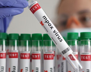 Đức xác nhận người đầu tiên mắc biến thể mới bệnh đậu mùa khỉ