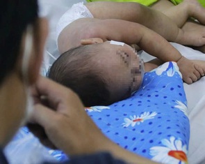 Số ca mắc sốt xuất huyết, tay chân miệng và sởi tại TP.HCM tăng