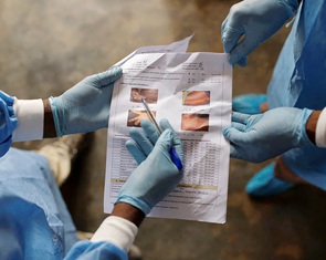 WHO triệu tập họp khẩn cấp về đậu mùa khỉ