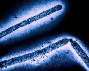 Vi rút H5N1 liên tục đột biến, nguy cơ lây lan nhanh ở người