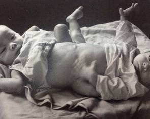 Phim về cặp song sinh Việt - Đức: Đức đang sống bằng cả cuộc đời của Việt