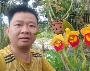 Mạch sống trong con: Chàng trai sống sót từ quả thận mẹ hiến