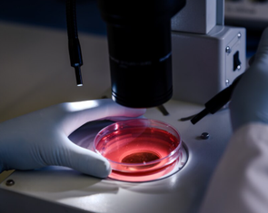 Công nghệ hình ảnh siêu nhạy giúp phát hiện ung thư sớm