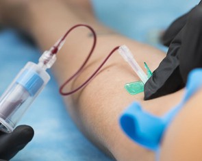 Xét nghiệm máu phát hiện ADN ung thư từ 3 năm trước khi chẩn đoán