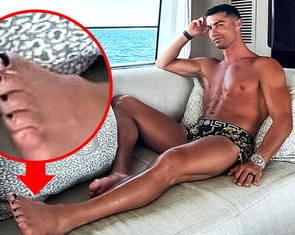 Vì sao Ronaldo sơn móng chân màu đen?