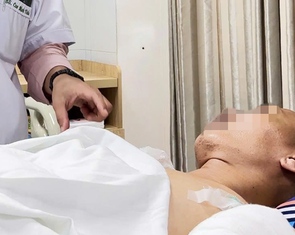 Cứu sống bệnh nhân lòi ruột, vỡ gan, đa chấn thương sau tai nạn giao thông nghiêm trọng