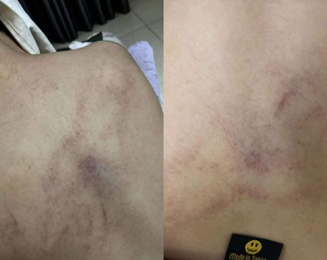 Gia đình tố cô giáo mầm non đánh, kéo lê, ném bé gái 4 tuổi vào tường
