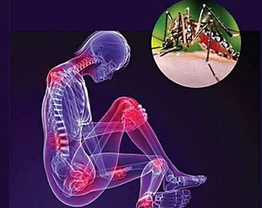 Dịch Chikungunya lan rộng liệu có nguy hiểm?