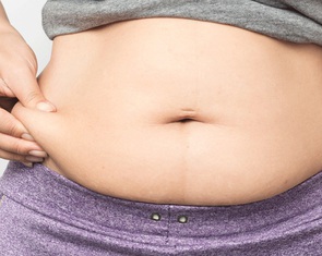 Béo phì không chỉ do 'ăn nhiều - ít vận động'