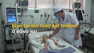 Bệnh sởi gia tăng bất thường ở Đồng Nai