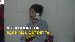 Vợ bị chồng cũ rạch mặt, cắt đứt tai