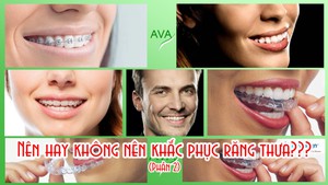 Nên hay không nên khắc phục răng thưa - Phần 2