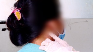 Bệnh nhi nhiễm 'vi khuẩn ăn thịt người' ở Đồng Nai đã khỏe mạnh và xuất viện