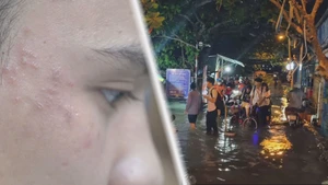 Góc nhìn trưa nay: Đề phòng bệnh viêm da do kiến ba khoang; TP.HCM và ĐBSCL bị ngập sâu, vì sao?