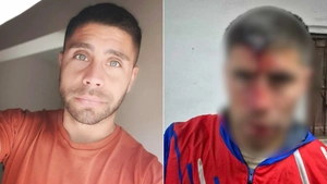 Cầu thủ người Argentina bị đâm thủng hộp sọ khi đến xem trận đấu bóng đá của con gái