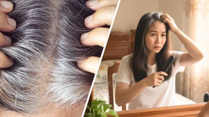 Vì sao tóc bạc sớm có thể là dấu hiệu cơ thể đang tự bảo vệ khỏi ung thư?