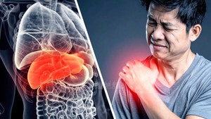 Bỗng dưng bị đau nhức vai bên phải, có khi là tín hiệu cầu cứu từ một cơ quan thiết yếu trong cơ thể