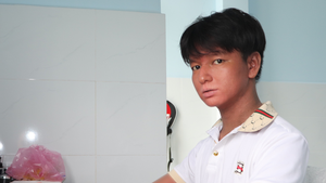 Nam sinh ‘người rắn’ dũng cảm bước vào đại học ở tuổi 24