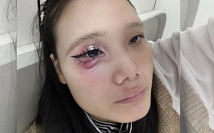 Ảnh vui 20-6: Mới học vẽ cái bọng mắt mà đọc bình luận muốn xỉu