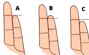 Quiz: Bạn là người vui vẻ, lạc quan hay là người nhạy cảm