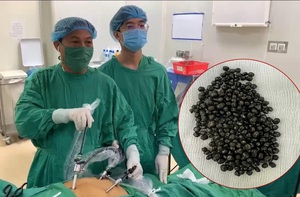 Người nhà bệnh nhân hốt hoảng khi thấy 320 viên sỏi trong túi mật