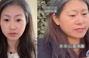 Bạc cả tóc chỉ sau một đêm khi biết chồng ngoại tình