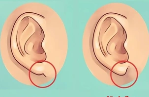 Quiz: Hình dạng dái tai tiết lộ gì về tính cách của bạn?