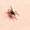 Nhật Bản phát hiện virus gây bệnh mới do bọ ve gây ra
