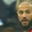 Fan rần rần phát hiện sao Man Utd cấy tóc