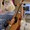 Vừa được mổ não vừa chơi guitar, sao hay thế?