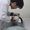 Tiêm filler tạo hình tai, ba năm sau cô gái 24 tuổi bị viêm nhiễm, áp xe